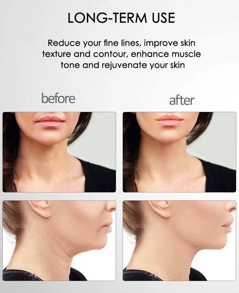 Velnixo FirmGlow Microcurrent Facial Massager