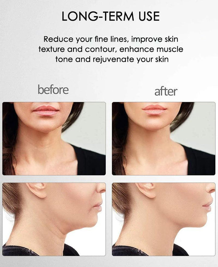 Velnixo FirmGlow Microcurrent Facial Massager